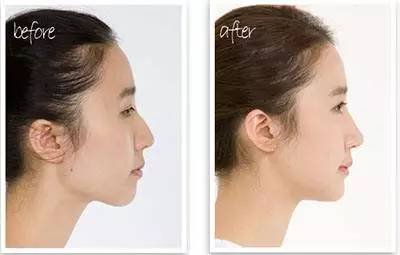 https://img.miyanlife.com/mnt/timg/170608/213R343a-6.jpg