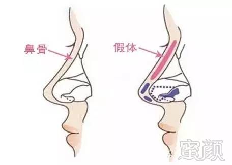 https://img.miyanlife.com/mnt/timg/170608/23395T3Z-5.jpg