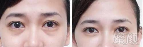 https://img.miyanlife.com/mnt/timg/170609/0136025619-5.jpg