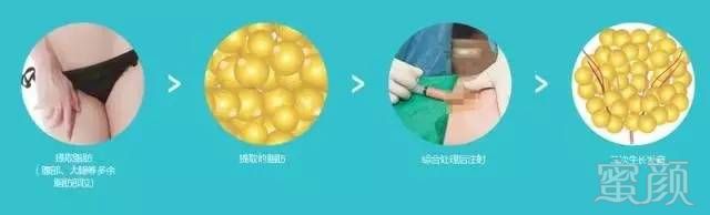 https://img.miyanlife.com/mnt/timg/170609/0136035333-8.jpg