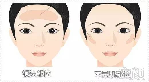 https://img.miyanlife.com/mnt/timg/170609/0136045U5-10.jpg
