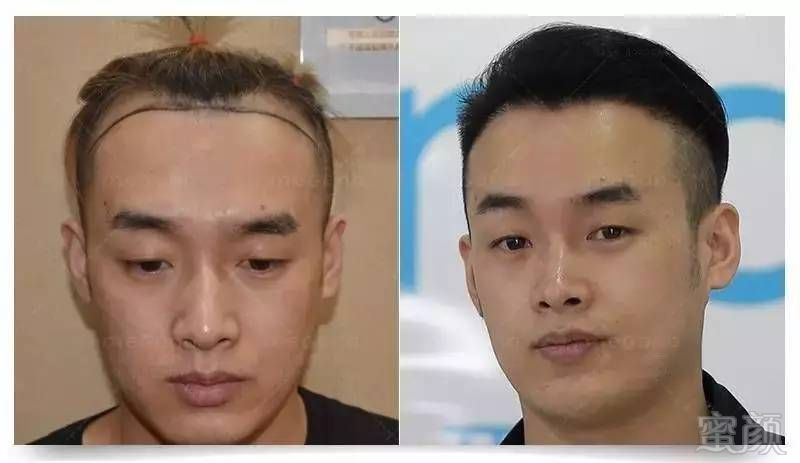 https://img.miyanlife.com/mnt/timg/170610/0049225Z9-7.jpg