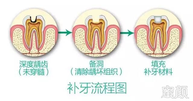 案例图片