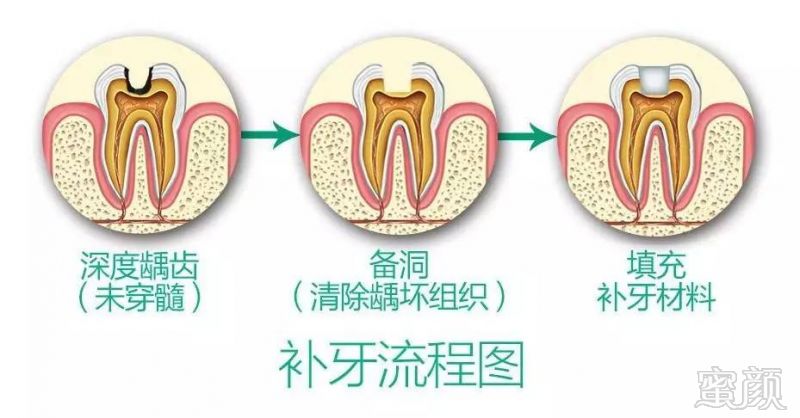 案例图片