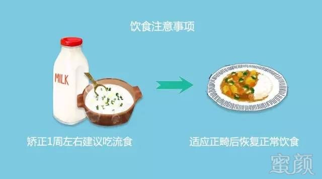 https://img.miyanlife.com/mnt/timg/170613/11440B364-3.jpg
