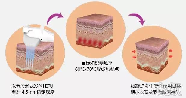 案例图片