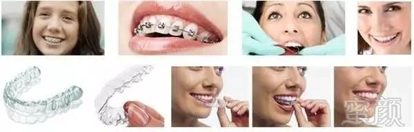 https://img.miyanlife.com/mnt/timg/170613/1K6331J7-6.jpg