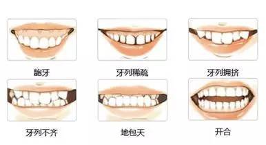 https://img.miyanlife.com/mnt/timg/170613/1K6335123-2.jpg