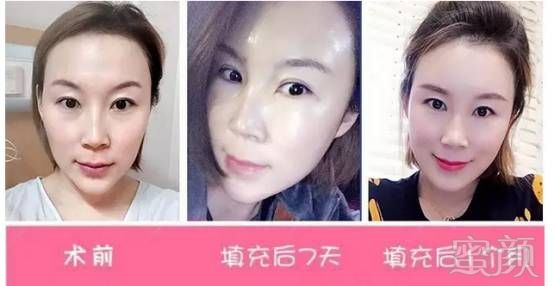 https://img.miyanlife.com/mnt/timg/170613/2259292095-3.jpg