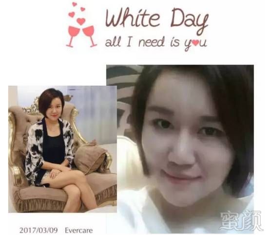 https://img.miyanlife.com/mnt/timg/170613/2259302A3-6.jpg