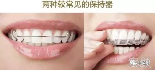 https://img.miyanlife.com/mnt/timg/170613/23231I315-7.jpg