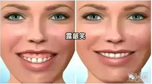https://img.miyanlife.com/mnt/timg/170613/23231IY0-6.jpg
