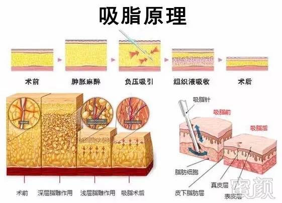 案例图片