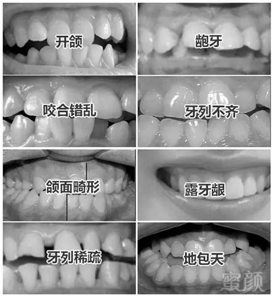 https://img.miyanlife.com/mnt/timg/170614/214PJ2W-1.jpg
