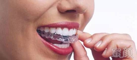 https://img.miyanlife.com/mnt/timg/170614/214PS100-2.jpg