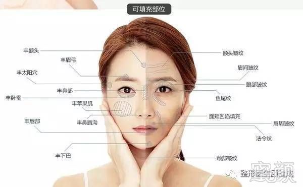 https://img.miyanlife.com/mnt/timg/170614/224213N04-7.jpg