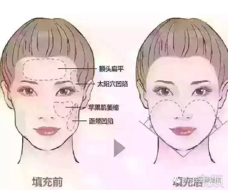 https://img.miyanlife.com/mnt/timg/170614/224214K60-9.jpg
