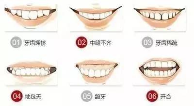 https://img.miyanlife.com/mnt/timg/170615/230224Da-1.jpg