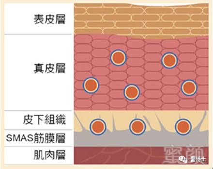 案例图片