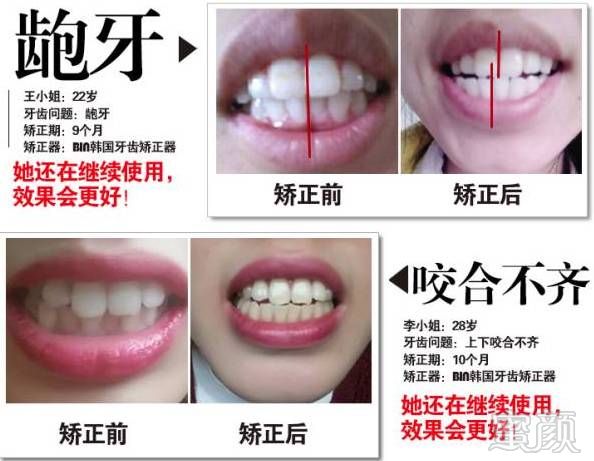 https://img.miyanlife.com/mnt/timg/170616/0203455923-5.jpg