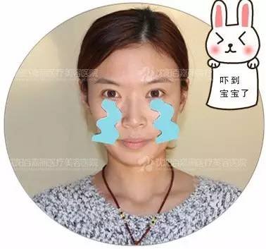 https://img.miyanlife.com/mnt/timg/170616/2140305061-1.jpg