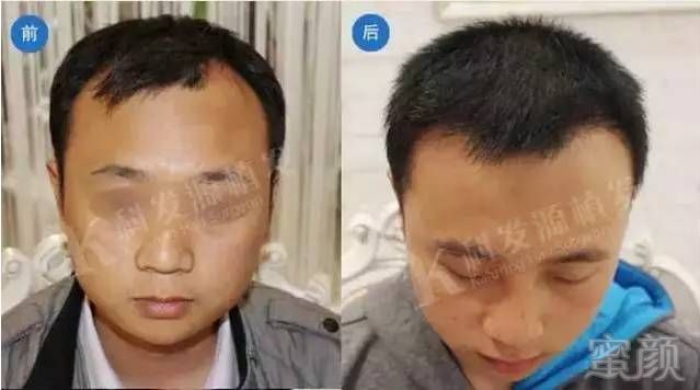 https://img.miyanlife.com/mnt/timg/170616/2253506008-1.jpg