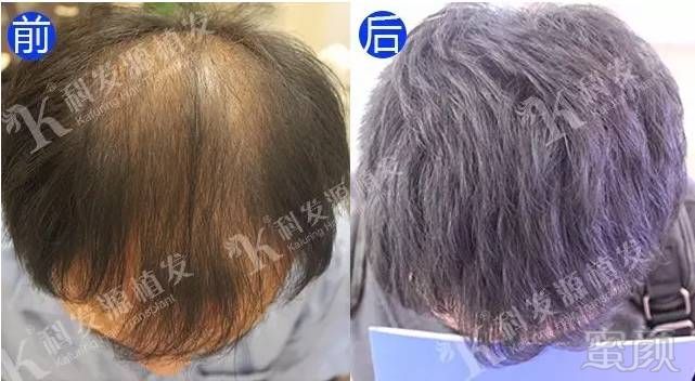 https://img.miyanlife.com/mnt/timg/170616/225350J20-0.jpg