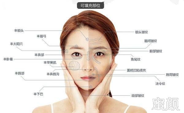 https://img.miyanlife.com/mnt/timg/170618/21261T144-10.jpg