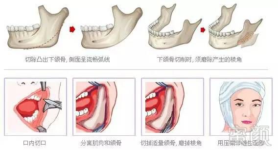 https://img.miyanlife.com/mnt/timg/170619/141H431D-3.jpg