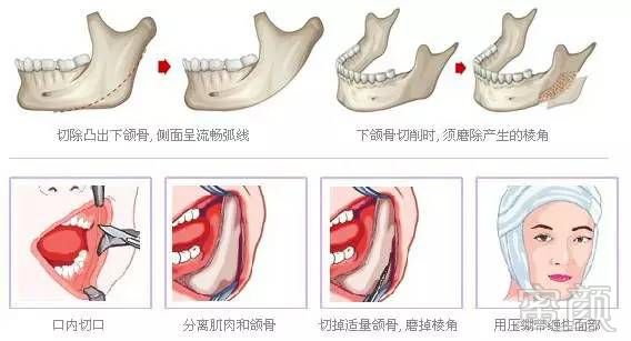 案例图片