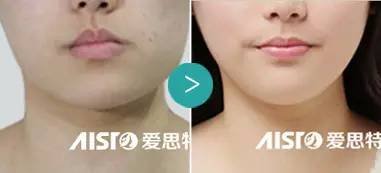 https://img.miyanlife.com/mnt/timg/170619/141H5C47-7.jpg
