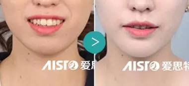 https://img.miyanlife.com/mnt/timg/170619/141H5F09-6.jpg