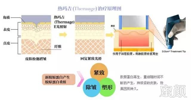 案例图片