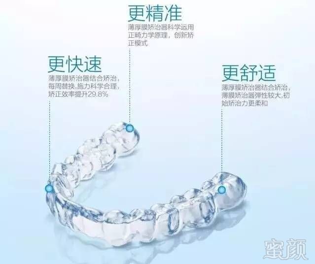 https://img.miyanlife.com/mnt/timg/170622/15201G2F-2.jpg