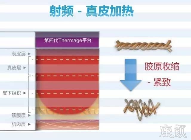 案例图片