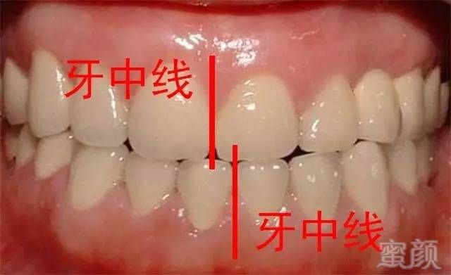 https://img.miyanlife.com/mnt/timg/170627/2024564K6-2.jpg