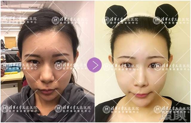 https://img.miyanlife.com/mnt/timg/170627/2200345222-4.jpg