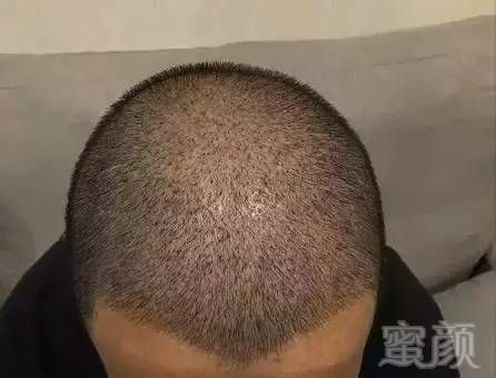 https://img.miyanlife.com/mnt/timg/170627/22095923J-9.jpg
