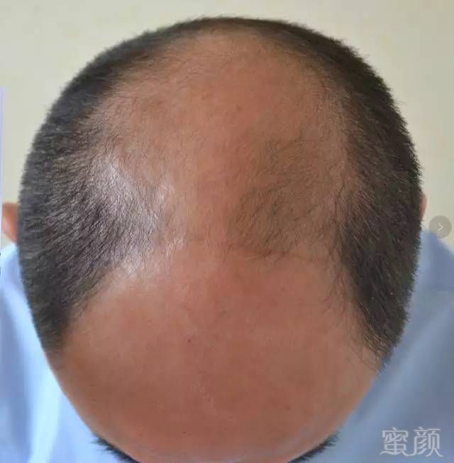 https://img.miyanlife.com/mnt/timg/170627/2209596451-10.jpg