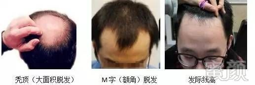 https://img.miyanlife.com/mnt/timg/170627/22095M348-4.jpg