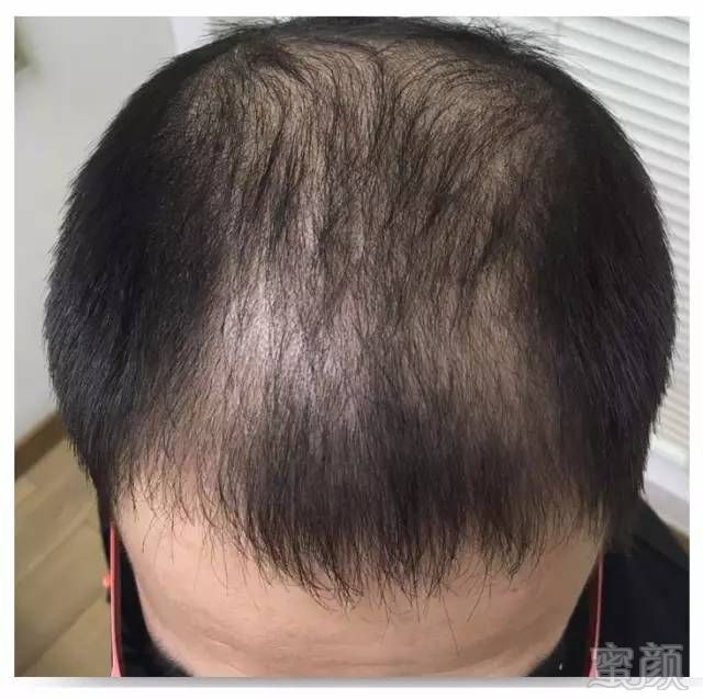https://img.miyanlife.com/mnt/timg/170627/22095RQ5-8.jpg