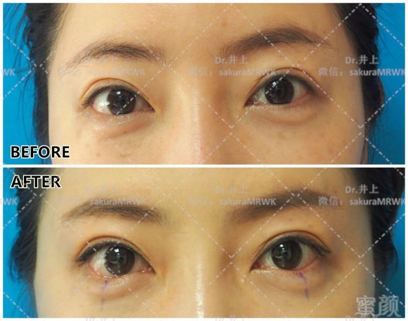 https://img.miyanlife.com/mnt/timg/170629/13022941U-6.jpg