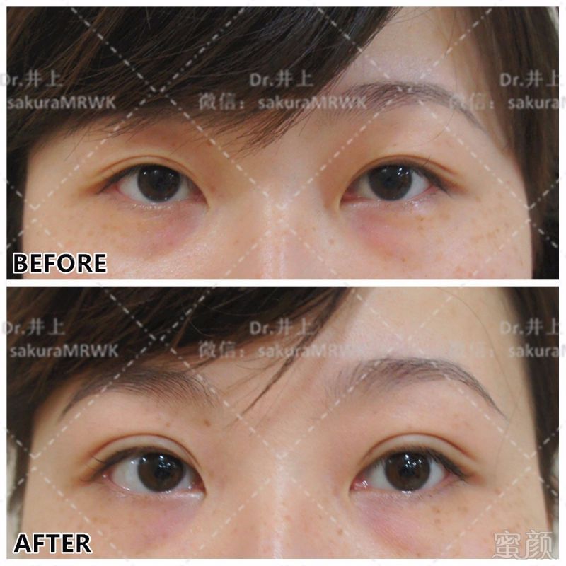 https://img.miyanlife.com/mnt/timg/170629/13022Ka1-1.jpg