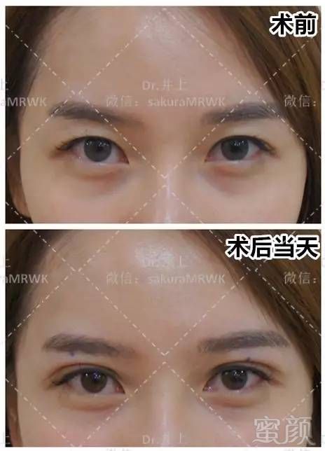 https://img.miyanlife.com/mnt/timg/170629/13022S355-3.jpg