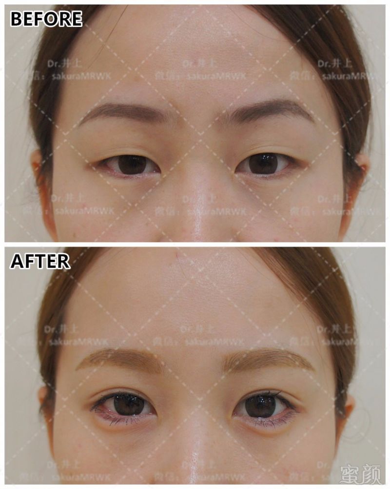 https://img.miyanlife.com/mnt/timg/170629/13022T250-5.jpg