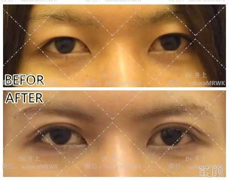 https://img.miyanlife.com/mnt/timg/170629/13022V125-4.jpg
