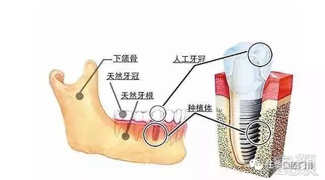 案例图片