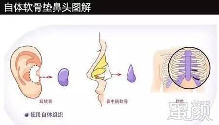 案例图片