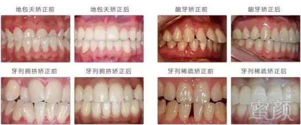 https://img.miyanlife.com/mnt/timg/170701/20122VM6-4.jpg