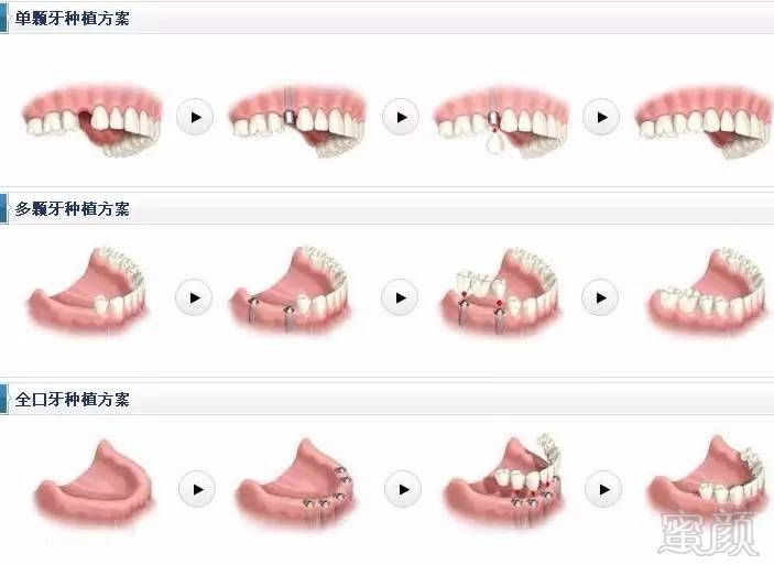 https://img.miyanlife.com/mnt/timg/170701/20511M4F-0.jpg